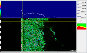 Sonographie