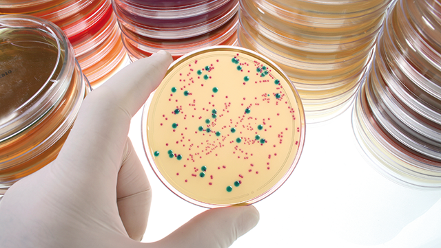 Hand die Petrischale hält