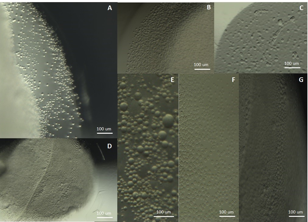 Protein dense liquid clusters, © UHH/AG-Betzel Protein dense liquid clusters