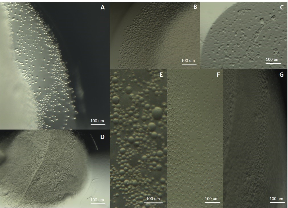 Protein dense liquid clusters