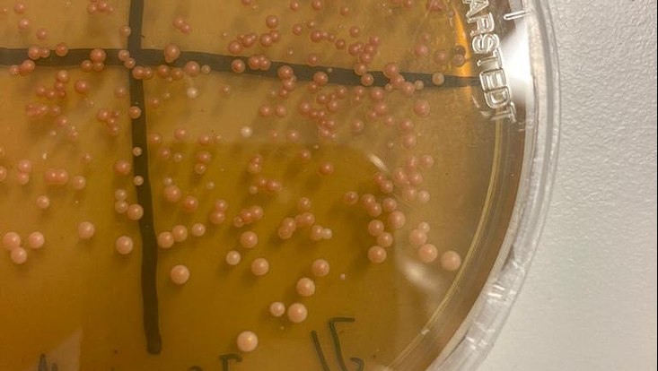 biogenetik-wise-22-23-10-733x414 Das Foto zeigt eine gelbliche Agarplatte mit Bakterienkolonien.