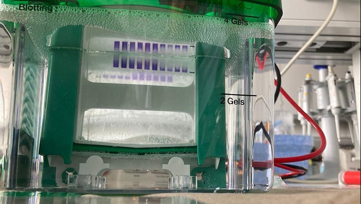 stoffwechsel-wise-22-23-1-733x414 ein laufendes SDS-Gel